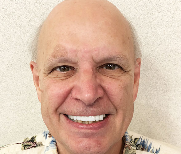 bob-dental-implant-service-smile